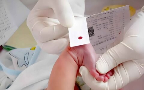 哪些国家代孕宝宝出生后必须做亲子鉴定？